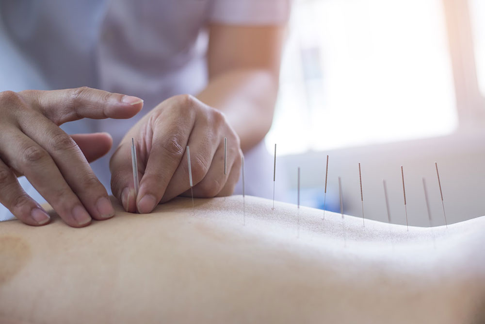Acupuncture and Post Operative Care